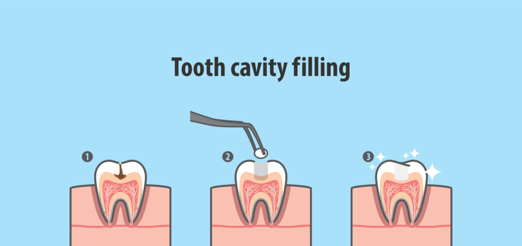 teeth gap filling clinic