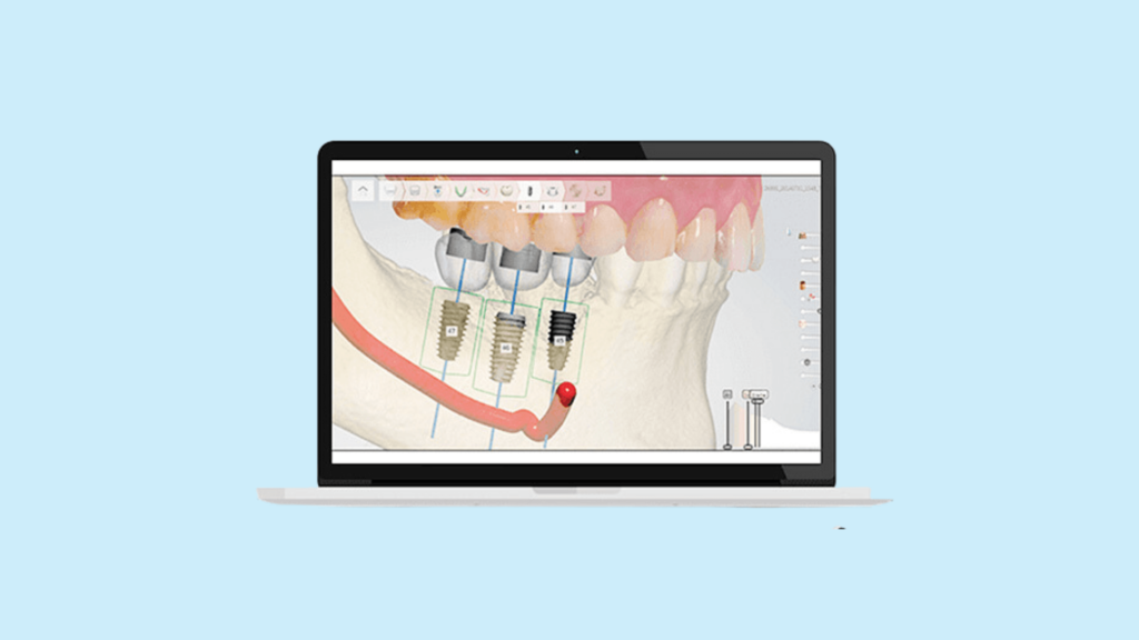 Dental Bridge Solution